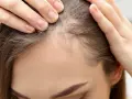 Kobieta sprawdza swoje włosy przy linii czoła, szukając sposobów, jak pozbyć się baby hair i uzyskać gładką fryzurę.