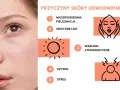 Przyczyny odwodnienia skóry: zła pielęgnacja, leki, warunki atmosferyczne, używki, stres.