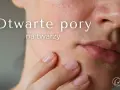Zbliżenie na skórę twarzy z widocznymi, otwartymi porami. Dłoń delikatnie dotyka policzka, podkreślając teksturę skóry.
