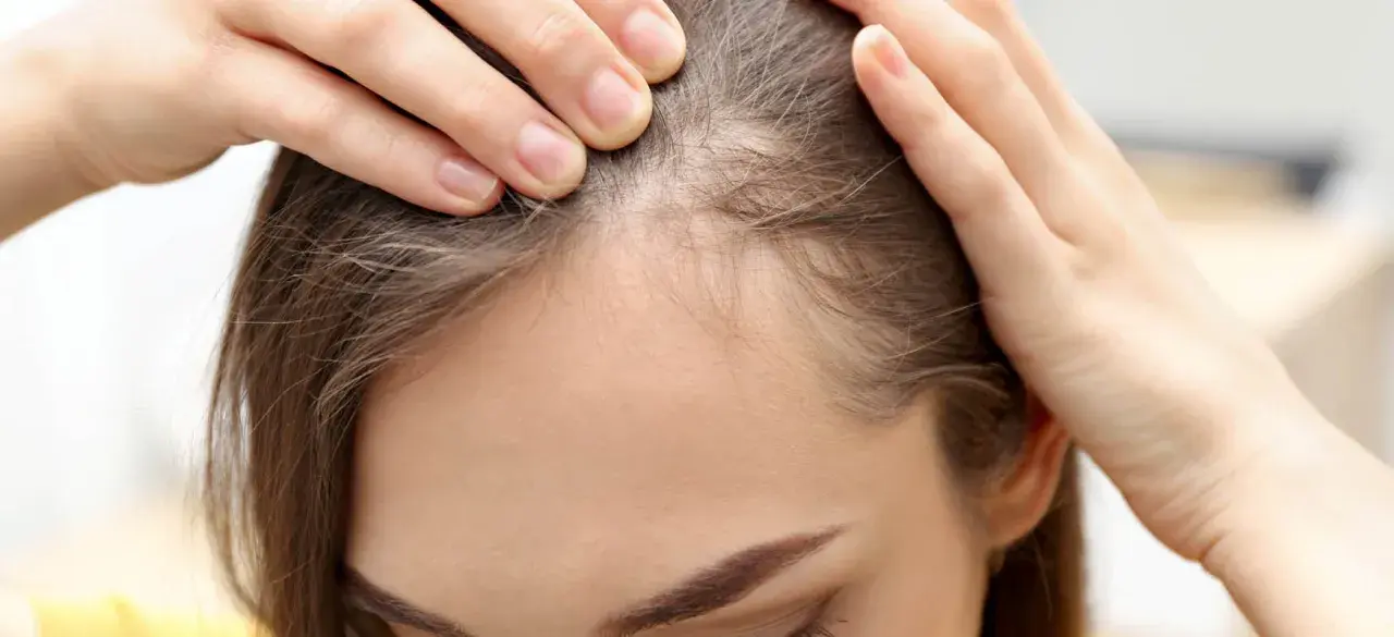 Kobieta sprawdza swoje włosy przy linii czoła, szukając sposobów, jak pozbyć się baby hair i uzyskać gładką fryzurę.