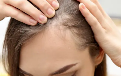 Kobieta sprawdza swoje włosy przy linii czoła, szukając sposobów, jak pozbyć się baby hair i uzyskać gładką fryzurę.