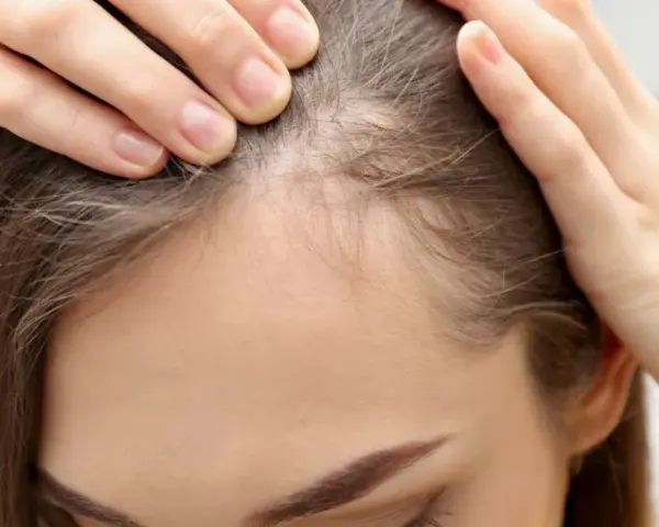 Kobieta sprawdza swoje włosy przy linii czoła, szukając sposobów, jak pozbyć się baby hair i uzyskać gładką fryzurę.