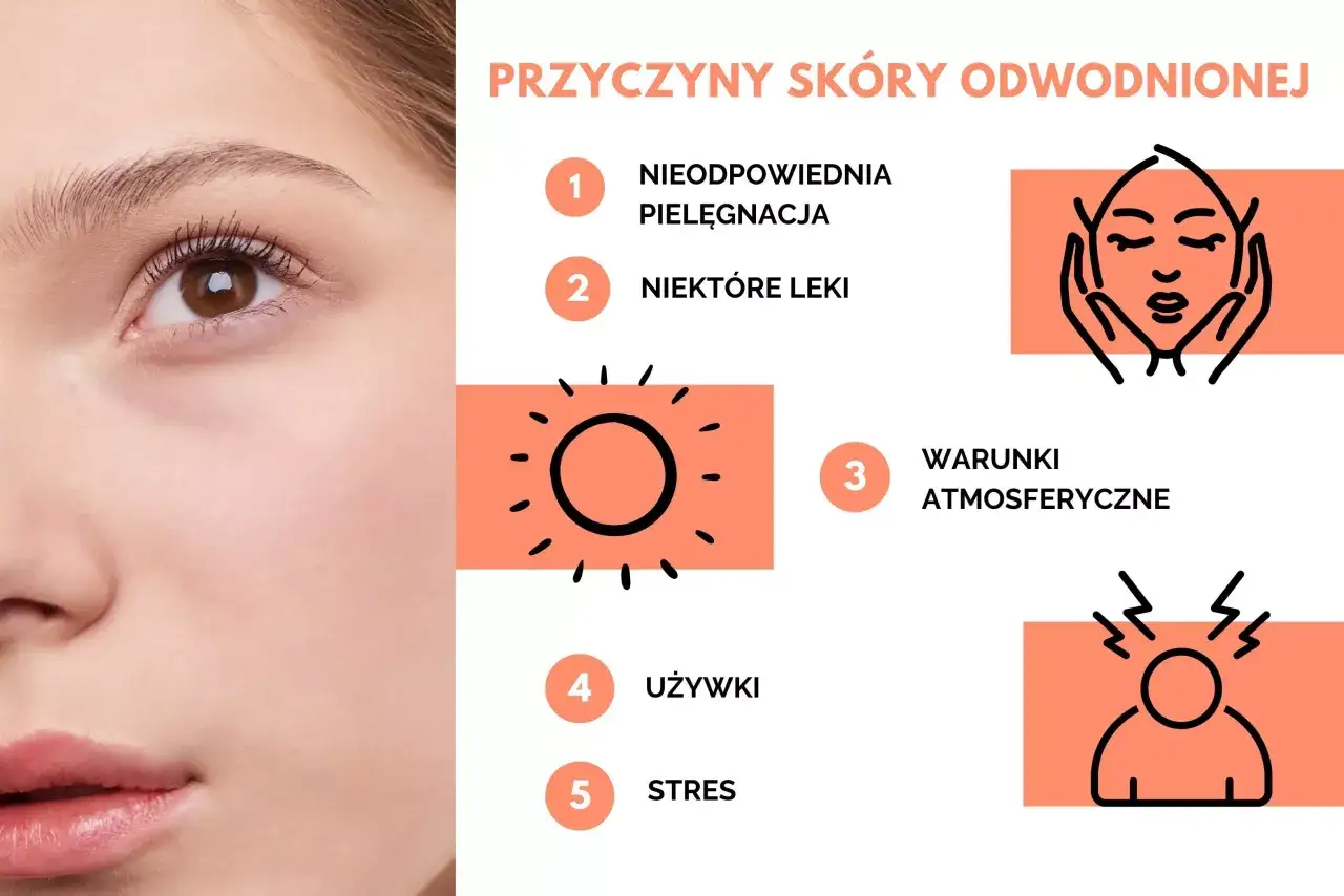 Przyczyny odwodnionej sk&oacute;ry: niewłaściwa pielęgnacja, leki, warunki atmosferyczne, używki, stres.